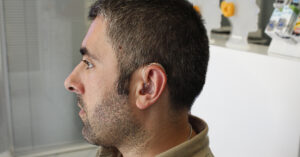 Man wearing a behind-the-ear hearing aid